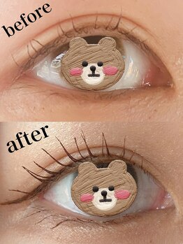 ラナビューティリゾート(Lana Beauty resort)/エグータムビフォアフ