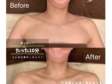 サロン ド レーヴ(Salon de Reve)/【お客様の事例】Billy’s Care