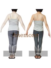 アネモネ/ダイエット/痩身/耳つぼ/腸活