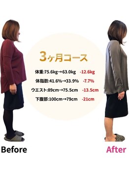 宮脇施術院/ダイエットビフォーアフター