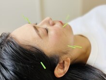 茶ノ木鍼灸整骨院/美容鍼 美肌トリートメント