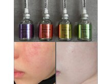 ハーブスキン(herb skin)の雰囲気（リジュランスキン★ジュエリートリートメントで肌質改善へ。）