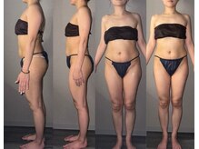 サロンスペース/40代 女性◆全身痩身 1回⇒6回目