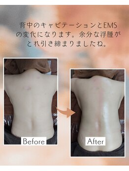 クリオネ(Clione)/背中凝り、浮腫解消