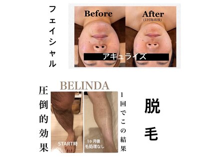 ベリンダ(BELINDA)の写真