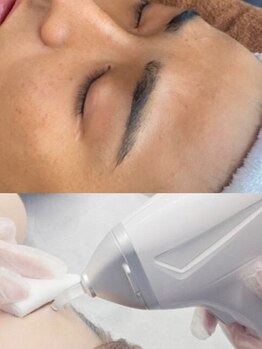 悠の写真/全身/腕・脚などパーツ/眉/ヒゲ脱毛までお得な価格でご用意♪痛みが少なくお肌に優しい◎脱毛効果に自信有!