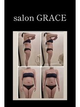 サロン グレイス(salon GRACE)/30代腹痩身