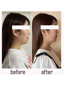 リタ(Rita.)/横顔もスッキリ