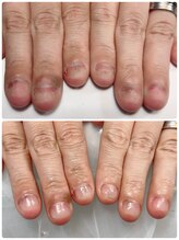 ピンキーネイル(Pinky nail)/自爪育成1回目のお客様