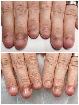 自爪育成1回目のお客様