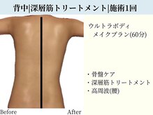 京都フォーエイチ(京都4H)/背中|深層筋トリートメント