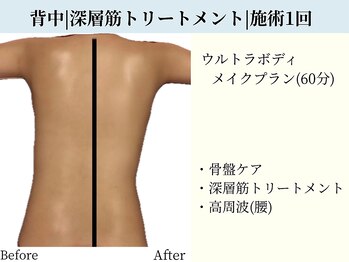 京都フォーエイチ(京都4H)/背中|深層筋トリートメント