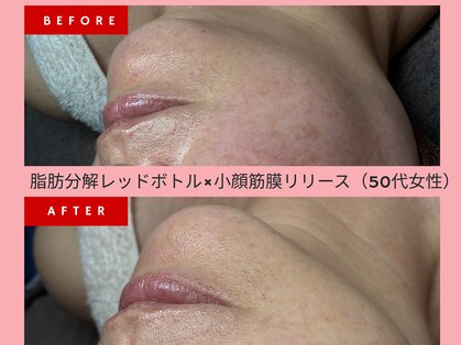 癒し工房ゆらぎ(YURAGI)の写真