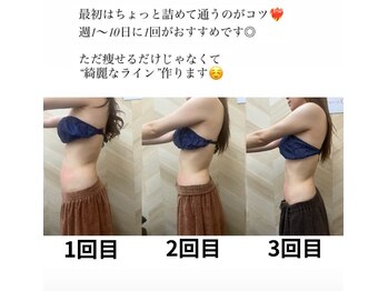 介正鍼灸整骨院 整体院 エフコープ大野城店/痩身エステ＊ビフォーアフター