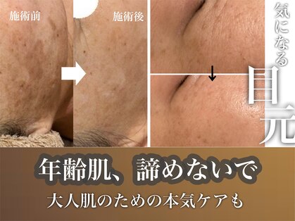 ヴィヴフォー(VIV for)の写真
