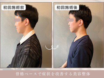 ほぐし屋 かすがい/初回/猫背巻き肩矯正
