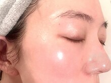 イヴトワエ(eiv Toi et A)の雰囲気（ヨーロッパの高機能化粧品を使用したフェイシャルトリートメント）