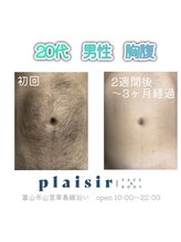 プレジール 富山店(plaisir)/全身脱毛(胸腹1回目)