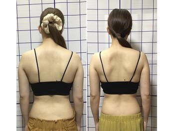 アリス フィットネスサロン/*ブライダル施術効果*