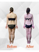 ビジュクイーン(BIJOU QUEEN)/１４キロのダイエットに成功