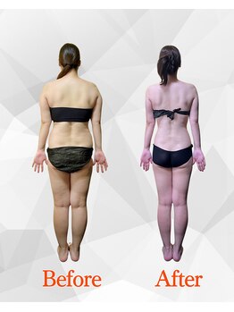 ビジュクイーン(BIJOU QUEEN)/１４キロのダイエットに成功