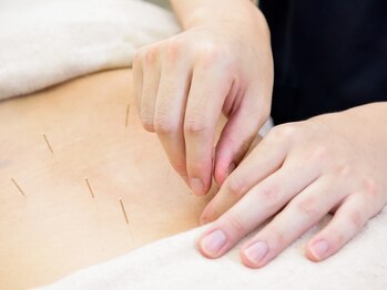 鍼灸整骨院ちとせの写真/【国家資格保有者が施術！】カウンセリングを重視しその場限りではなく身体の根本から改善に導きます♪