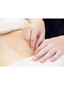 鍼灸施術を受けたい