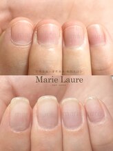 マリーロール 淀屋橋本店(Marie Laure)/自爪育成/深爪矯正/ネイルケア