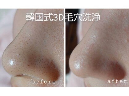 ビアンカーラ(Biancara)の写真