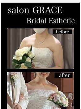 サロン グレイス(salon GRACE)/
