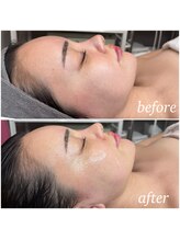 レイ(Rey)/毛穴レス艶感アップのメニュー！