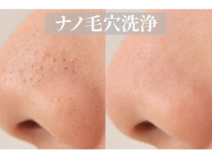 VS28スキンケアスタジオ バリイン 札幌駅前(BALI IN)の写真