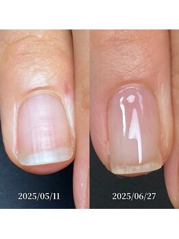 ココ(COCO)/ハンドケア・自爪育成・深爪育成