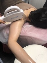 ドクターアリィ(Dr.ALII)/施術風景4レディース腕脱毛★