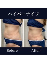 ハリルル 併設 GLケンタ鍼灸整骨院(HARILULU)/薄着になる準備できていますか？