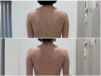 シルク ド ココ(Silk de Coco)/リジュゲルマ