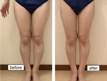 ルシエル ハカタ(Luciel HAKATA)/痩身120分×週1回3ヶ月(20代)