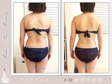 メロウプラス(メロウ+)の雰囲気（ハイパーナイフEX＋筋膜リリース体脂肪率-10.5% 体重-6.8キロ）