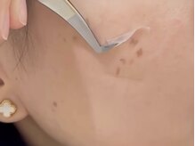 ウルト アルティメイトスキン(ULT ultimate skin)