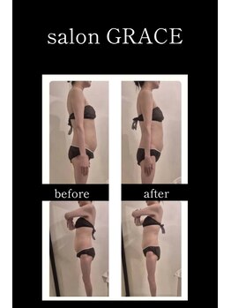 サロン グレイス(salon GRACE)/50代腹痩身1回ビフォーアフター