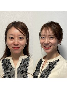 パーソナルサンフラワー(PersonalSunflower)/お客様ヘアメイク Before/After