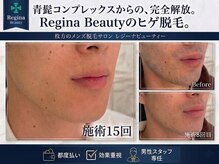 レジーナビューティー(Regina Beauty)/短期間で確かな脱毛！