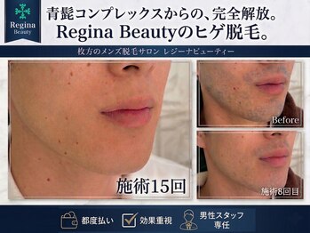 レジーナビューティー(Regina Beauty)/短期間で確かな脱毛!
