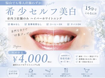 アン セプト(an-SEPT.)の写真/たった15分で驚きの仕上がり！セルフホワイトニング初回4000円【市内で3店舗のみ】