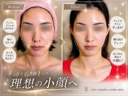 タロ(talo)の写真