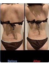 サロン ココ(COCO)/くびれ