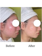 グラシア 宇土店(gracia)/