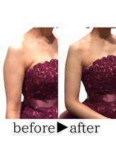 スタイルアップボディ ナゴミ(スタイルアップBODY！NAGOMI)/脂肪撃退★最強ブライダルエステ