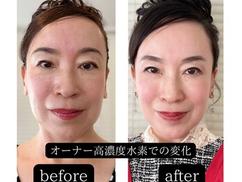 ヨサパーク エミリア(YOSA PARK Emiria)/オーナーの変化