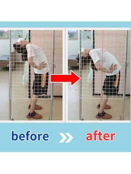 ストレッチヒーロー 鳥取店(STRETCH HERO)/反る動き